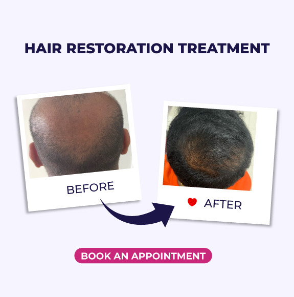 Hair Regrowth Before and After